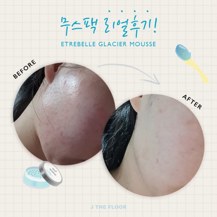 무스팩 오로지 최신 사이트 후기 ! 정말 무조건 여름철 필수! 딥포어젤 증정 ! 최다구성