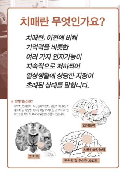 치매 관련주 총정리 치매 관련주 총정리