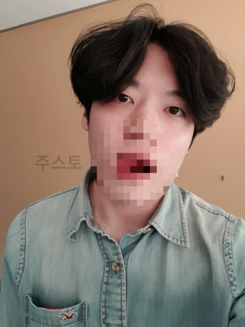 남자 머리기르기 장발스타일 가는 길 거지존 탈출 꿀팁 대방출 : 네이버 블로그 남자 머리기르기 장발스타일 가는 길 거지존 탈출 꿀팁 대방출 : 네이버 블로그