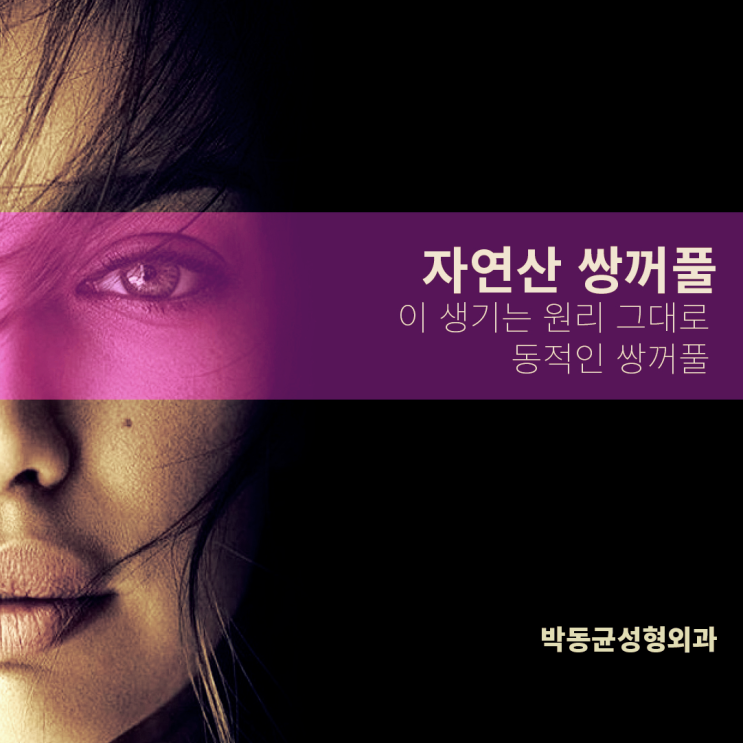  광주쌍꺼풀 작년에 수술했던 아이가 친구 상담에 따라왔어요.