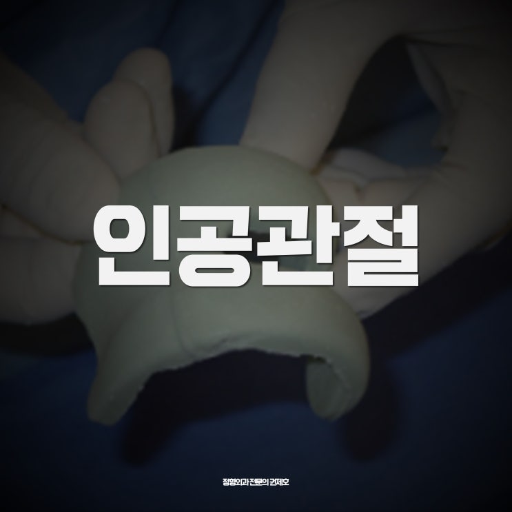  인공관절치환술 arthroplasty 무릎관절염 걷기 힘들다면