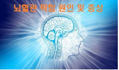  뇌혈관 막힘 원인 및 증상