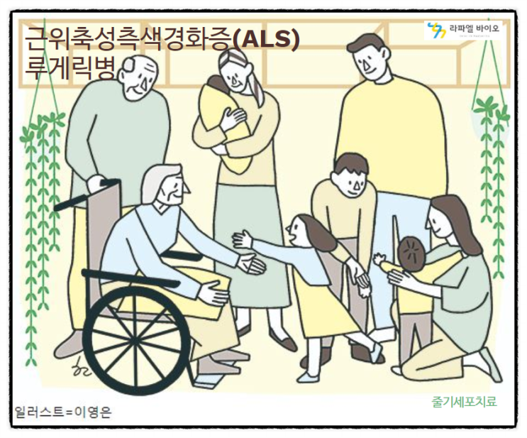 루게릭병 증상과 오진, 치료방법은 무엇일까?