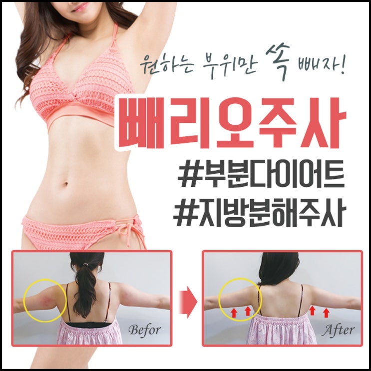  선릉 피부과여름이벤트 이곳!