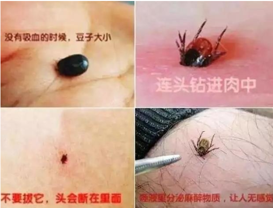 진드기 관련주 총정리 진드기 관련주 총정리