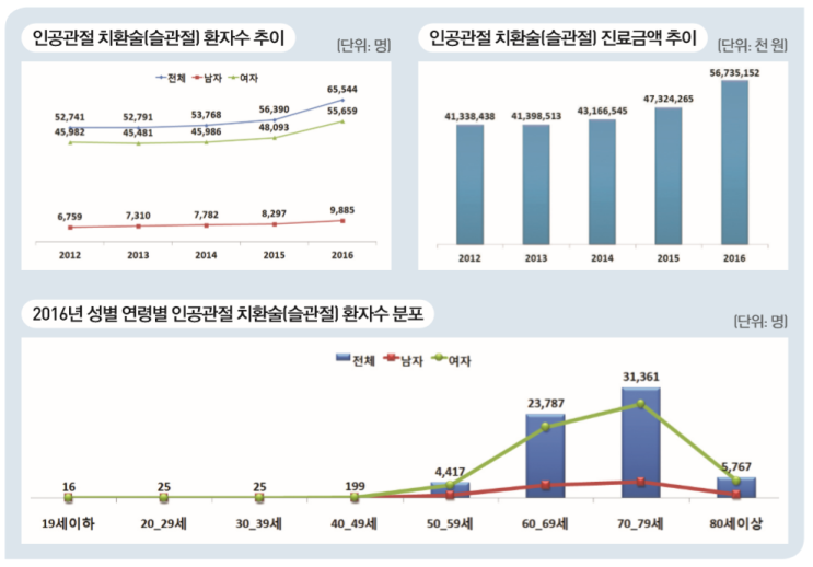  인공관절치환술(슬관절)