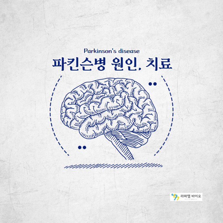  파킨슨병의 진단과 치료는 바로 이것?