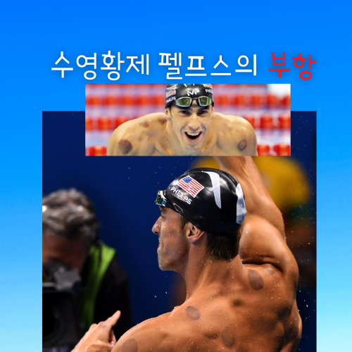  펠프스의 부항