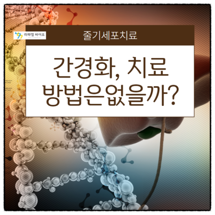  간경화, 치료방법은 없을까?