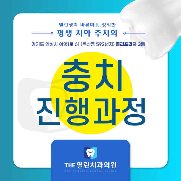  안성추천치과에서 충치진행과정 알려드려요!