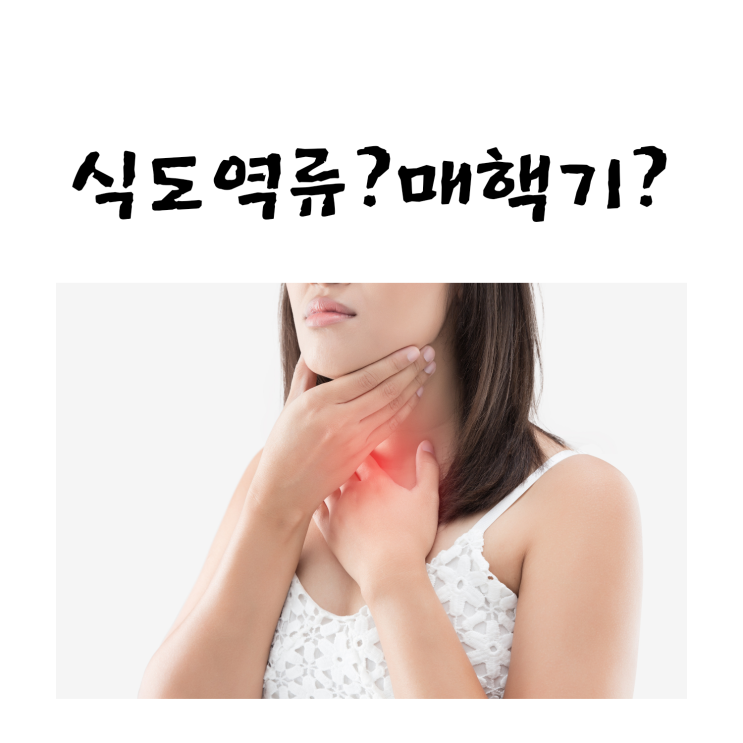  식도역류?매핵기!