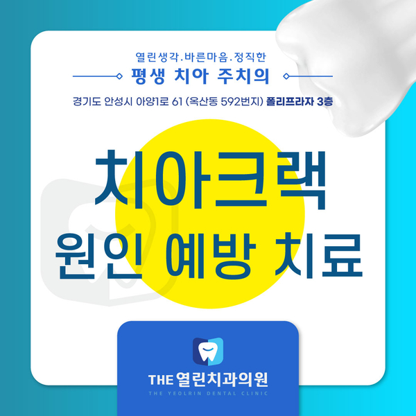  안성추천치과에서 치아크랙 치료하세요