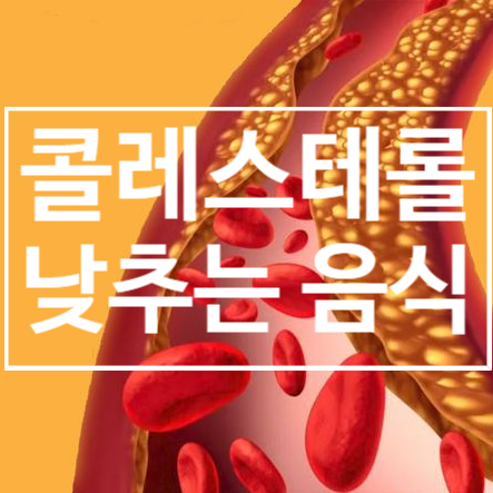  콜레스테롤 낮추는 음식으로 고지혈증 관리하기