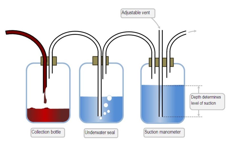 22. chest tube(흉관튜브 간호)