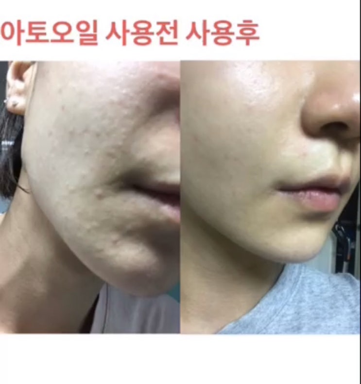  내일 오전 11시 올리고더미 구매시 콜라겐 매트리콜 한박스 증정 + 뿐만 아니라 다양한 사은품!