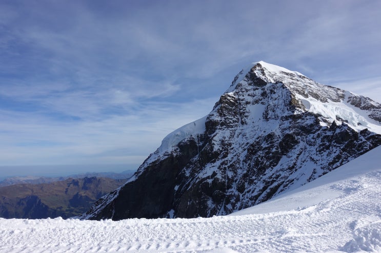  연하곤란 삼킴 장애 원인과 치료