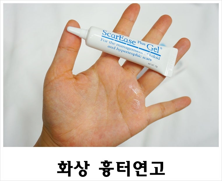 연고를 제거하는 화상 상처 처분할 수 있는 간호 눈 흉터 - 잔나비