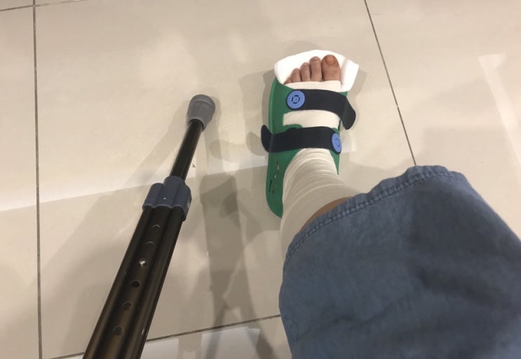  발목 접질렸을 때, 목발 짚고야 비로소 보이는 것들