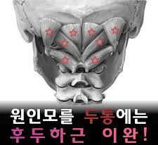  온라인 PT "원인 모르는 두통에는 이 근육을 풀어주세요"