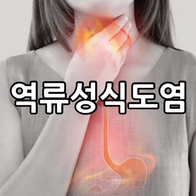  역류성식도염 증상과 영양관리
