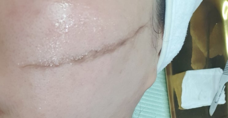  논현역 속눈썹 맛집 블루밍제이에서 스킨플래닝 받고 왔어요~