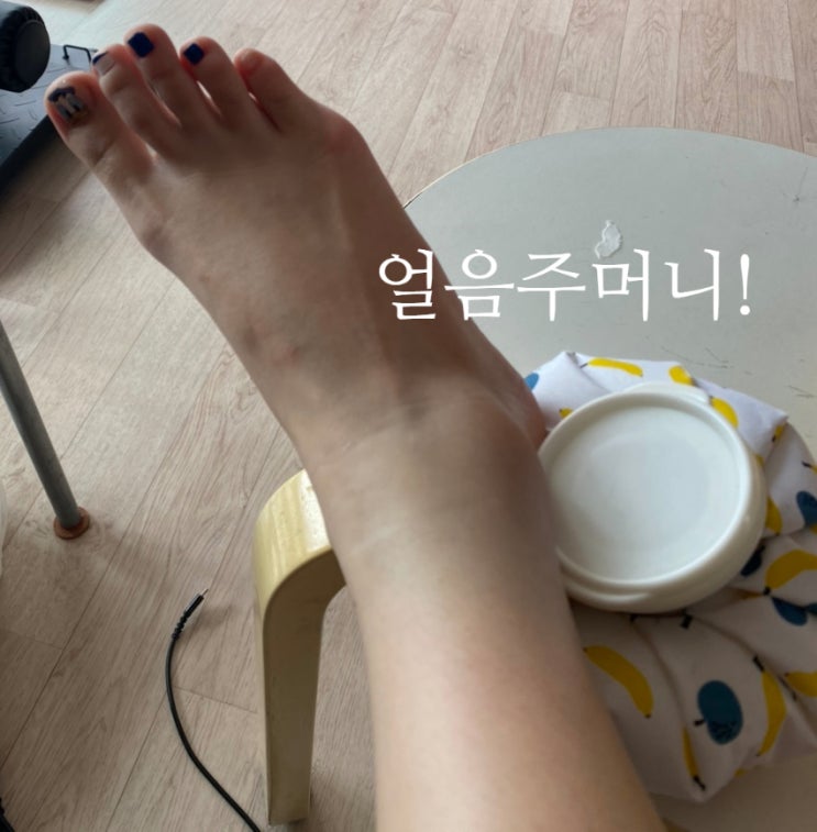  발목 접질렀을때 냉찜질 파스 병원 운동까지!