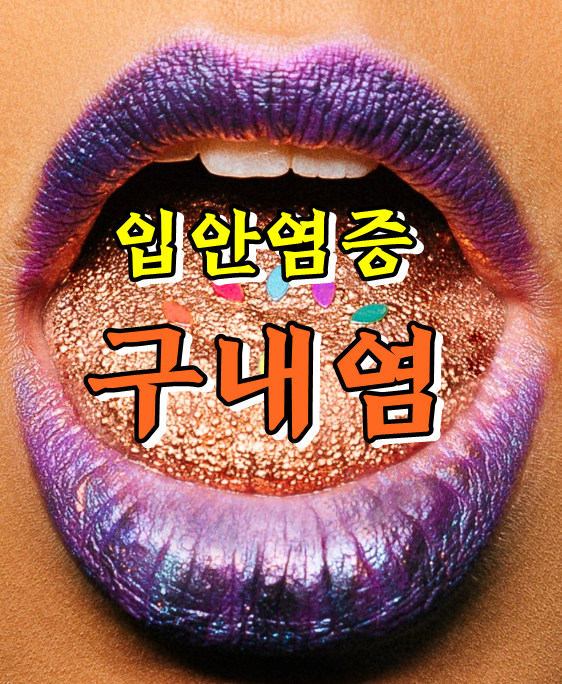  궤양성, 수포성, 미란성 구내염! 주의하세요.