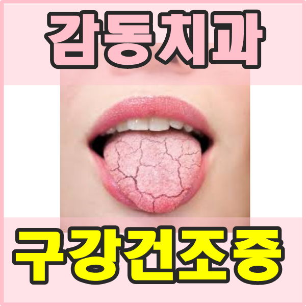  당감동치과*입안이너무건조해요-구강건조증