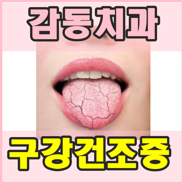 당감동치과*입안이너무건조해요-구강건조증