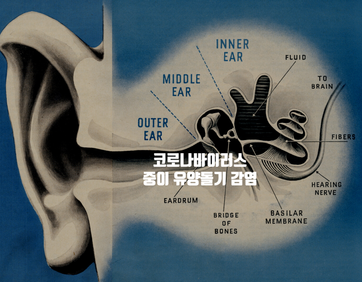  코로나바이러스 중이 및 유양돌기 감염