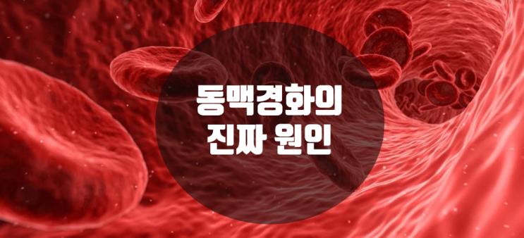  동맥경화의 진짜 원인