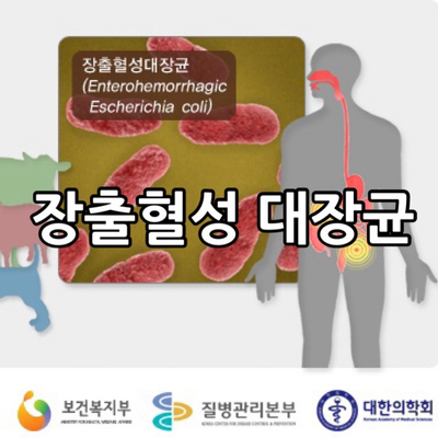  장출혈성 대장균 식중독 원인과 증상, 예방하는 방법은 무엇일까요?