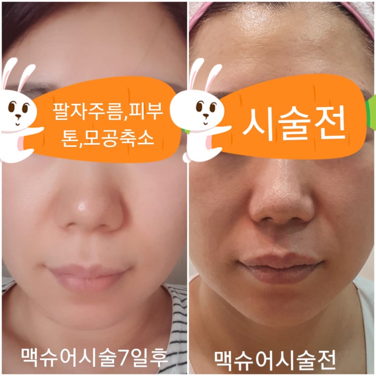  서귀포시 서귀동 피부관리&왁싱 제주도민 최대 50% 할인쿠폰 정보!