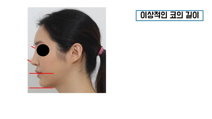  당신만 모르는 코성형 기준