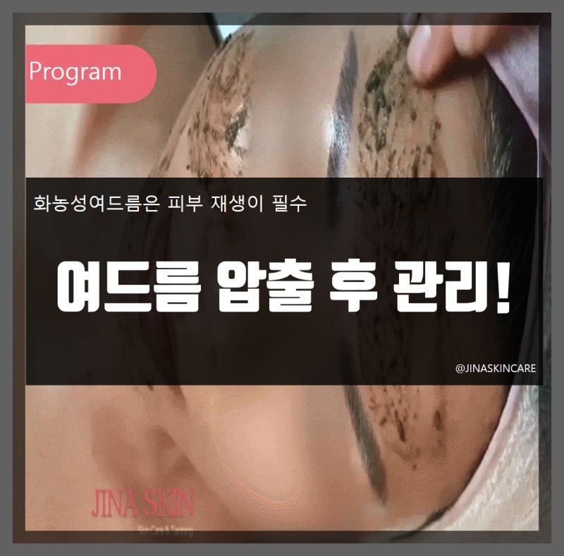 여드름 압출 후에는 사후관리가 필수적입니다 2