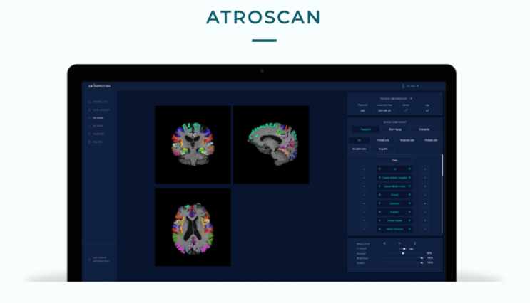  제이엘케이(JLK) 에이아이허브(AIHub) - ATROSCAN 건강검진용 뇌 노화 및 치매 분석 솔루션