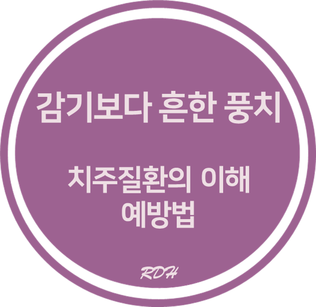 감기보다 흔한질병 풍치 :: 치주질환 원인과 예방법