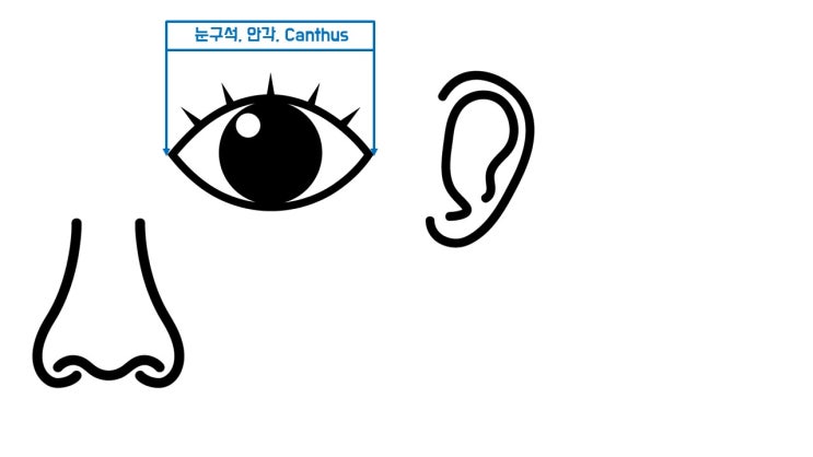  트임성형 받을 때 최소한 알아야 OOOO