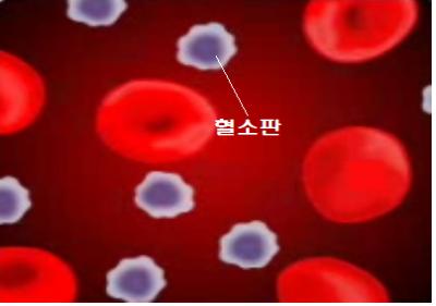  혈소판 수치 감소 원인 및 증상