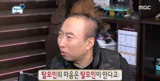  탈모원인 DHT 호르몬 전환 억제 : 카페인효능 음주 활성산소 카페인샴푸