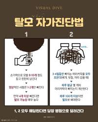  탈모에 좋은 식습관 식품 탈모영양소 : 아연 구리 마그네슘 비타민 요오드