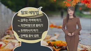  여성탈모의 원인과 종류 생활습관 : 갱년기탈모 측두부탈모 원형탈모 탈모약물치료