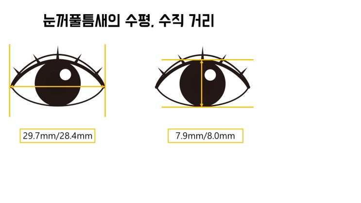  내 눈크기가 눈성형이 필요할 만큼 작나?