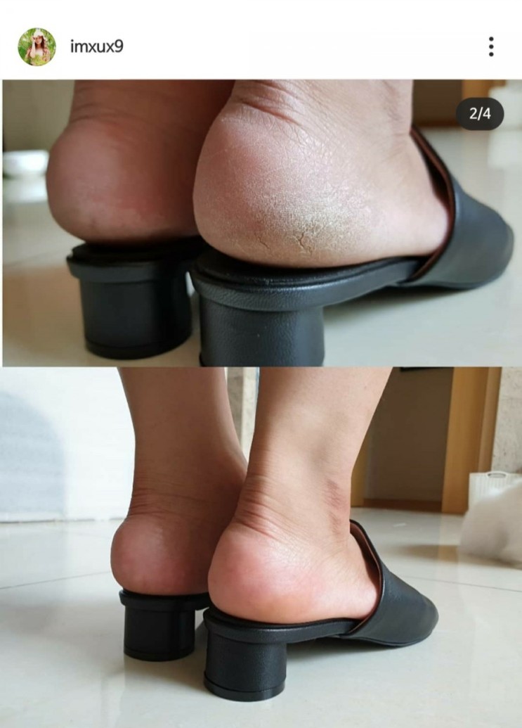 발 뒷꿈치 각질제거 페디세이션 세라믹 풋파일 (고은아언니 추천템)