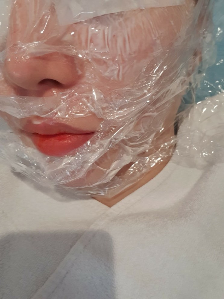  내돈내산 압구정피부과 슈퍼프락셀 받은 당일, 다음날~일주일 후기