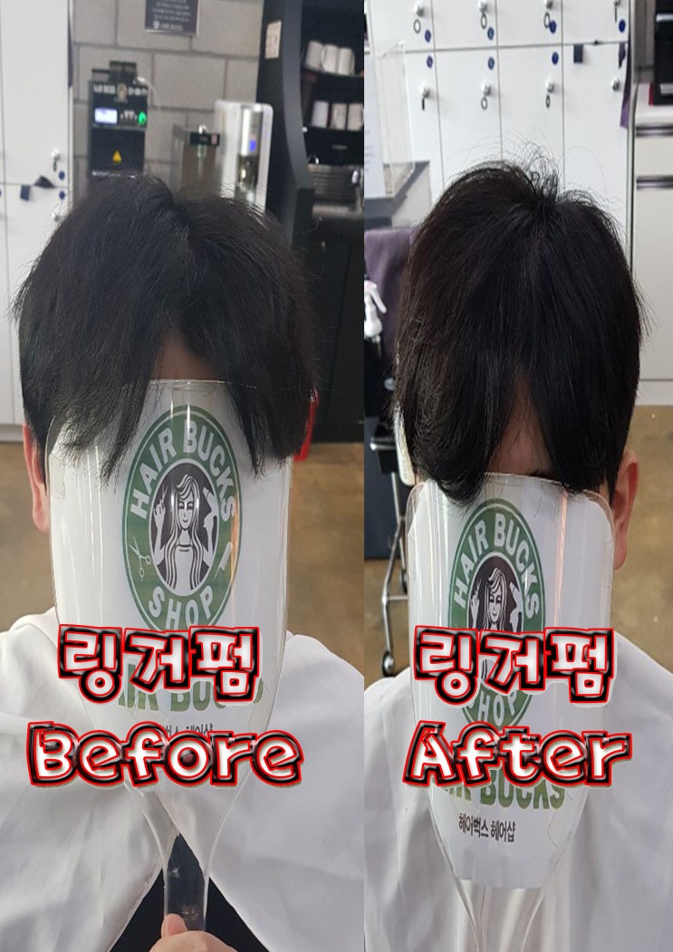  M자 머리 커버 링거펌전문 헤어벅스