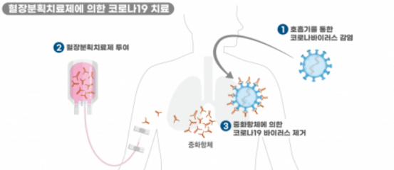 혈장치료제 관련주 FDA 승인 (녹십자, 시노펙스 주가 전망)