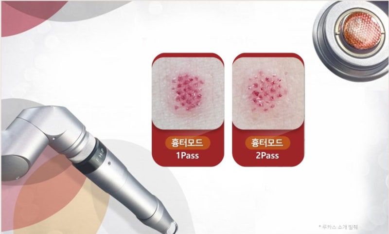 [장비소개]루카스플러스(LUCAS PLUS) : 네이버 블로그