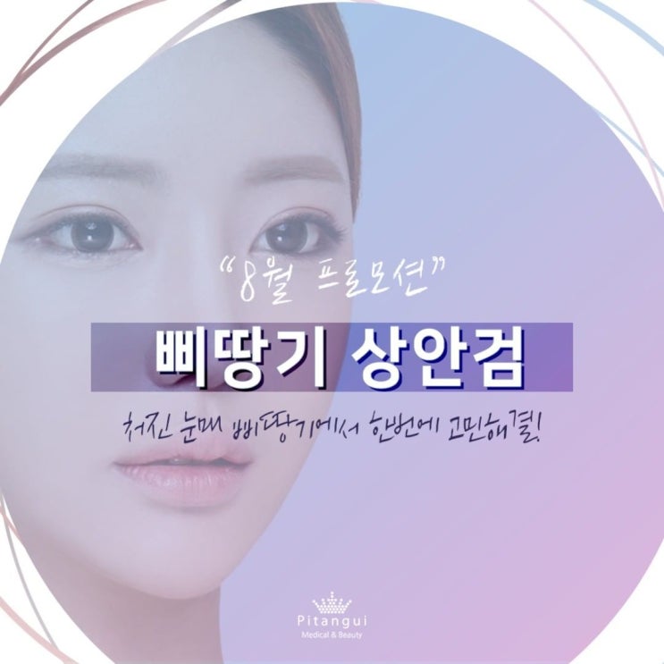  삐땅기 상안검수술 8월 프로모션 가격 궁금하다면