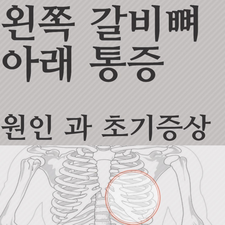 왼쪽 갈비뼈 아래 통증 원인 및 초기증상